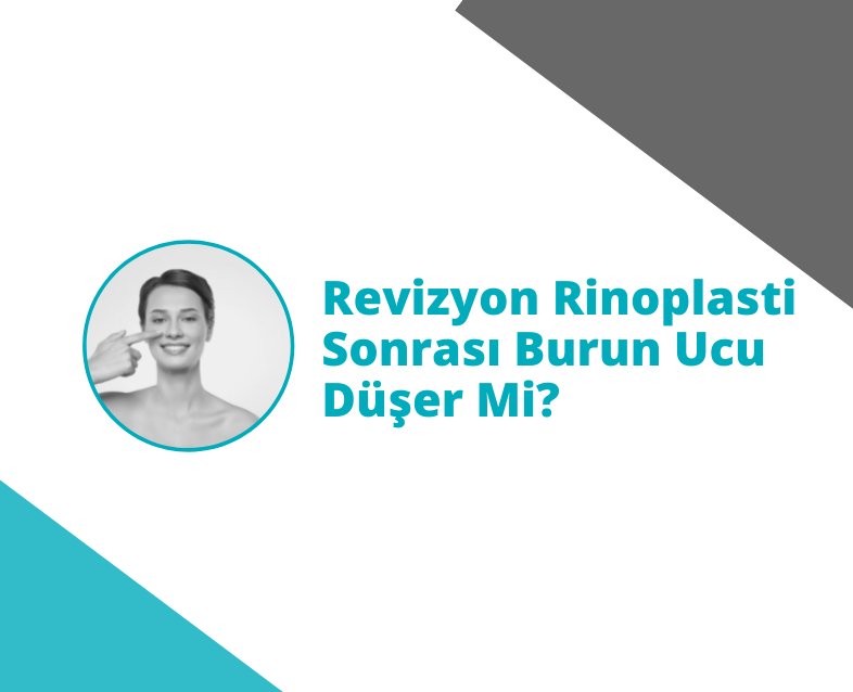 Revizyon Rinoplasti Sonrası Burun Ucu Düşer Mi?
